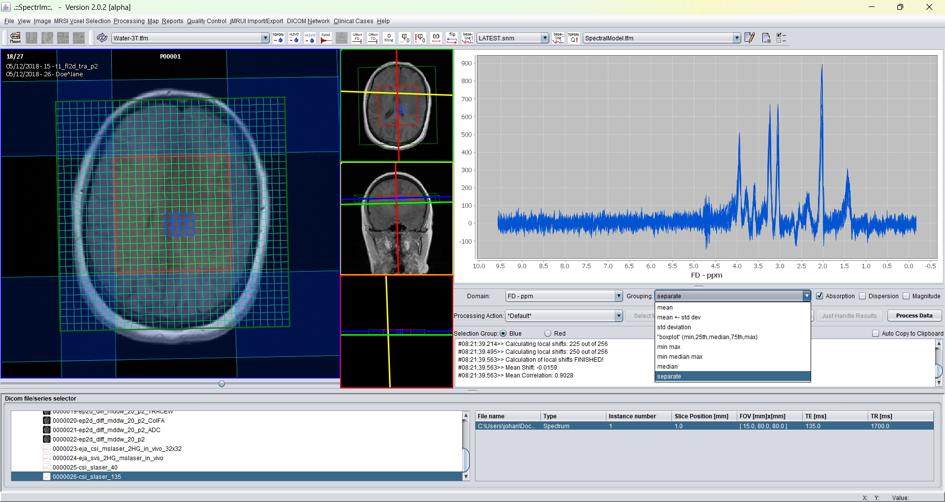 spectrIm-QMRS - list of several spectrum display mode for multiple voxels of an MRSI-dataset